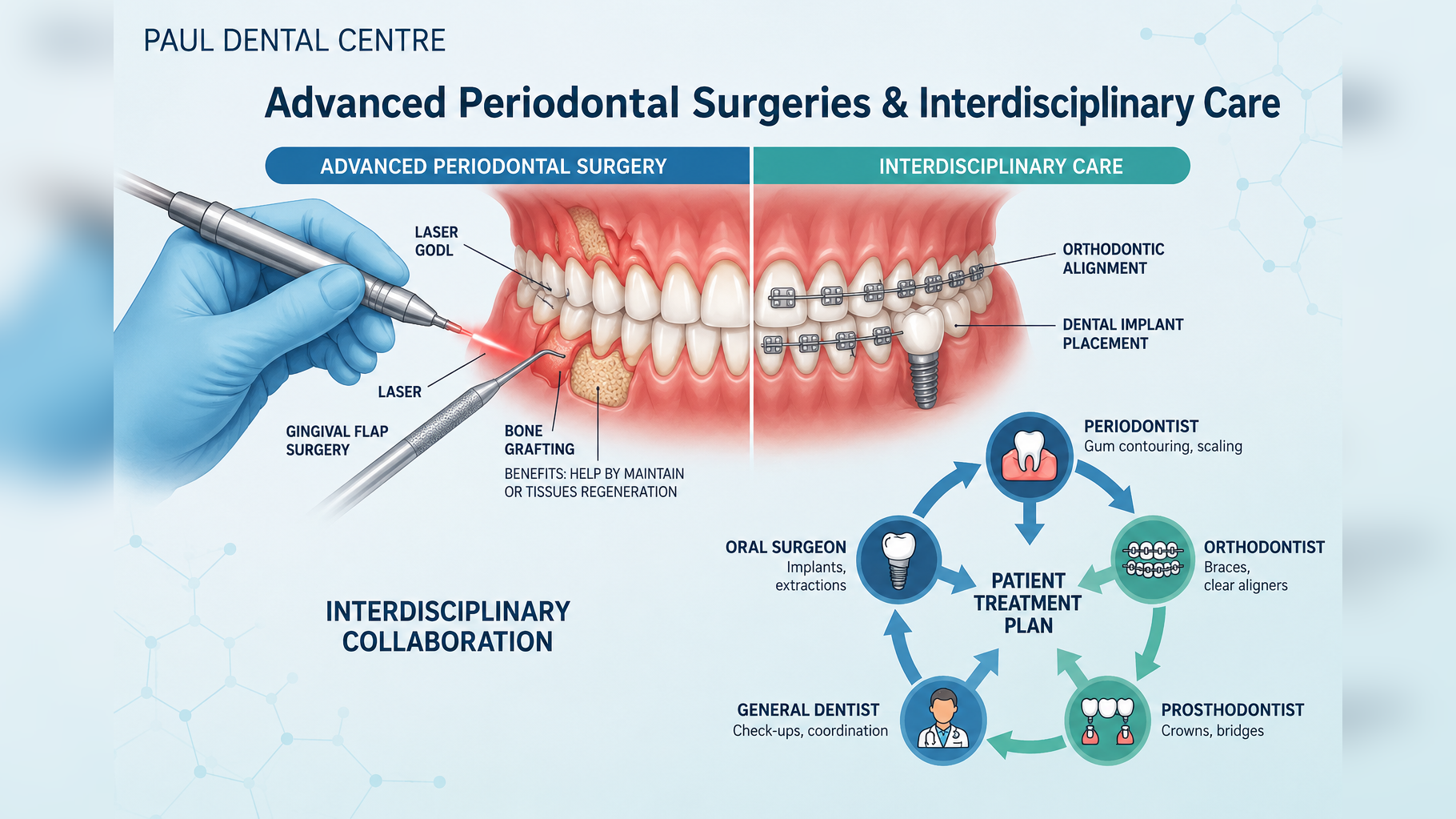 Advanced Periodontal Surgeries
